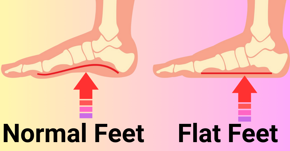 insoles for flat feet