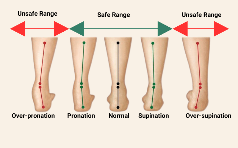 supination insoles