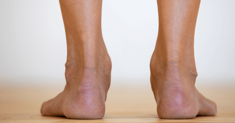 best orthotics for overpronation and flat feet